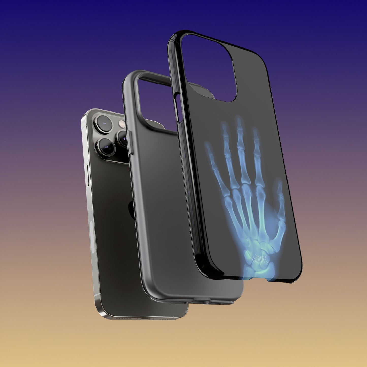 The Radiograph Tough Case