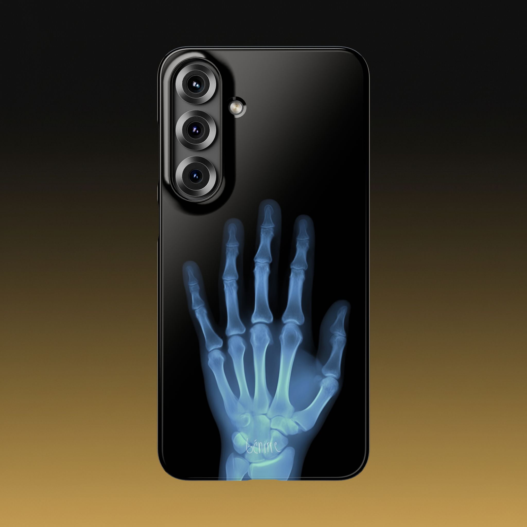 レントゲンライト