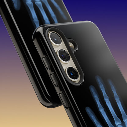 The Radiograph Tough Case