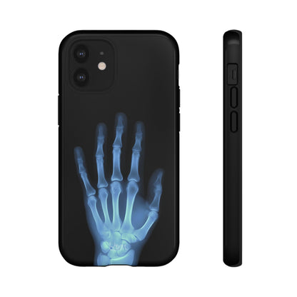 The Radiograph Tough Case