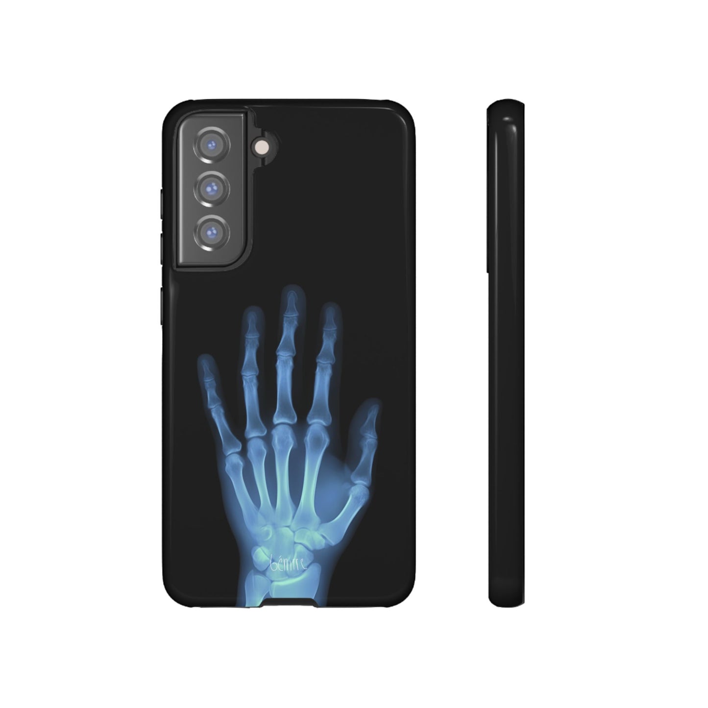 The Radiograph Tough Case