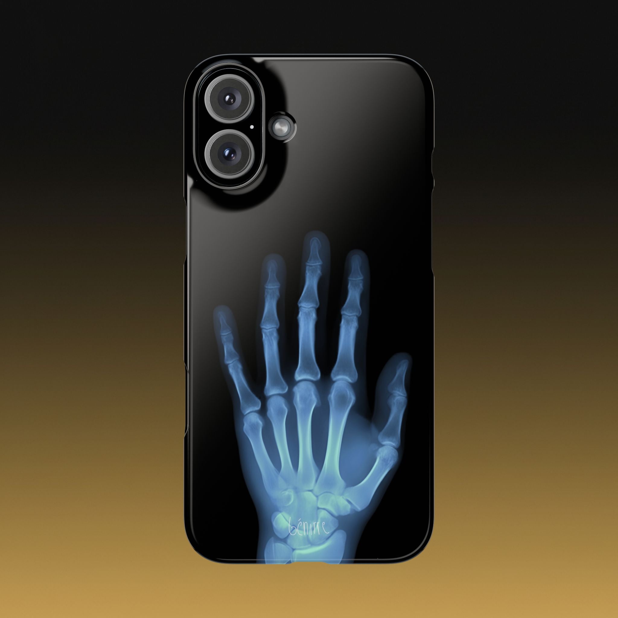 レントゲンライト