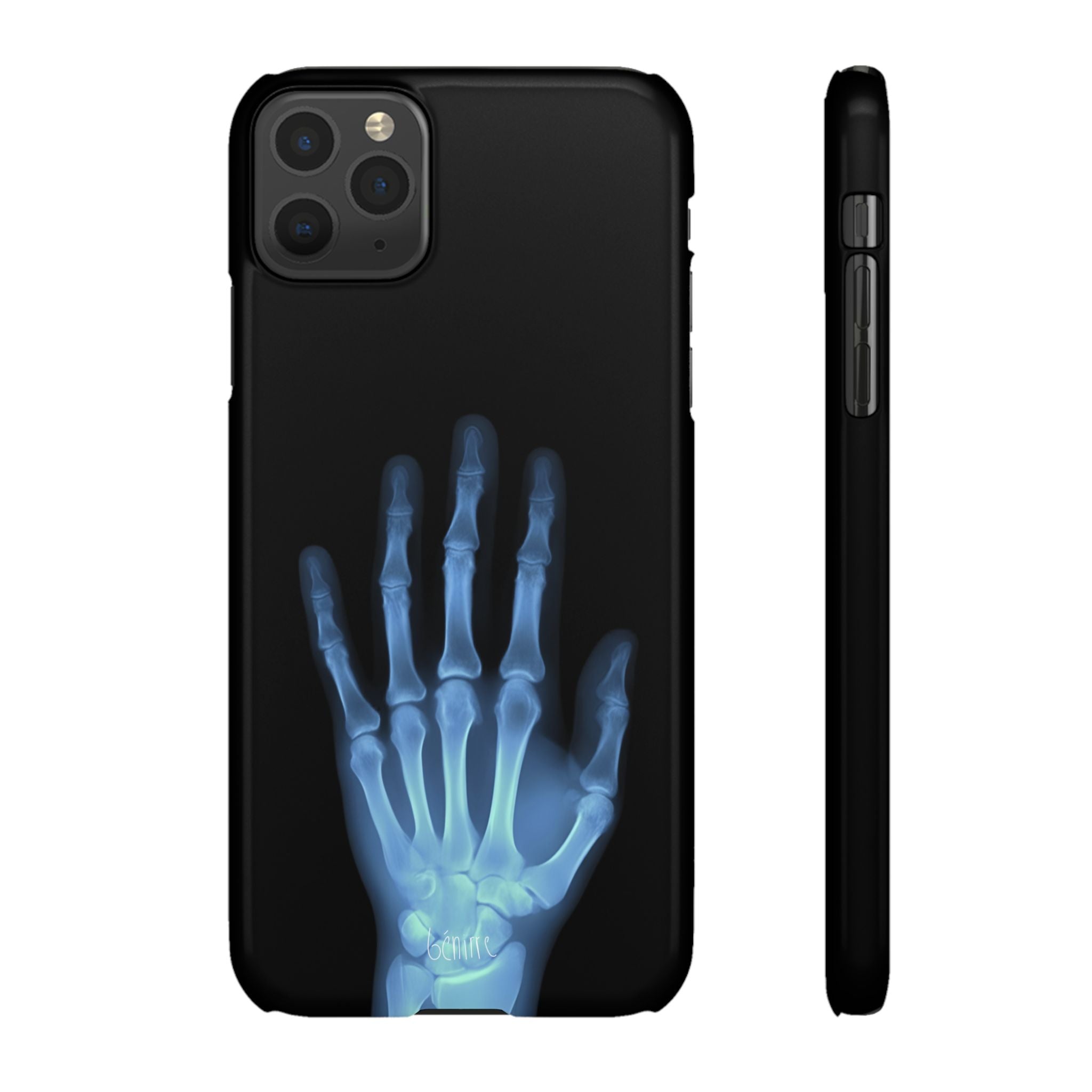 レントゲンライト