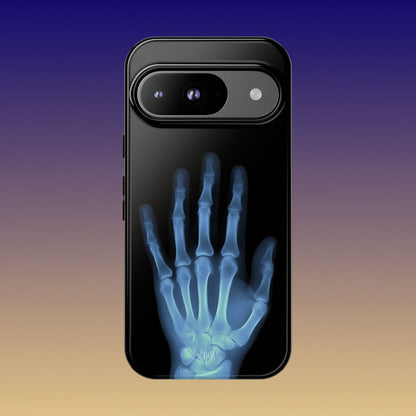 The Radiograph Tough Case