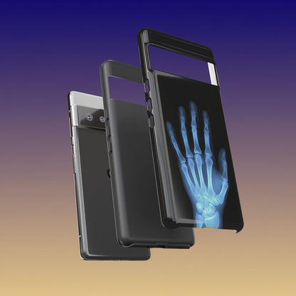 The Radiograph Tough Case