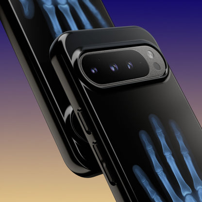 The Radiograph Tough Case