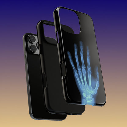 The Radiograph Tough Case