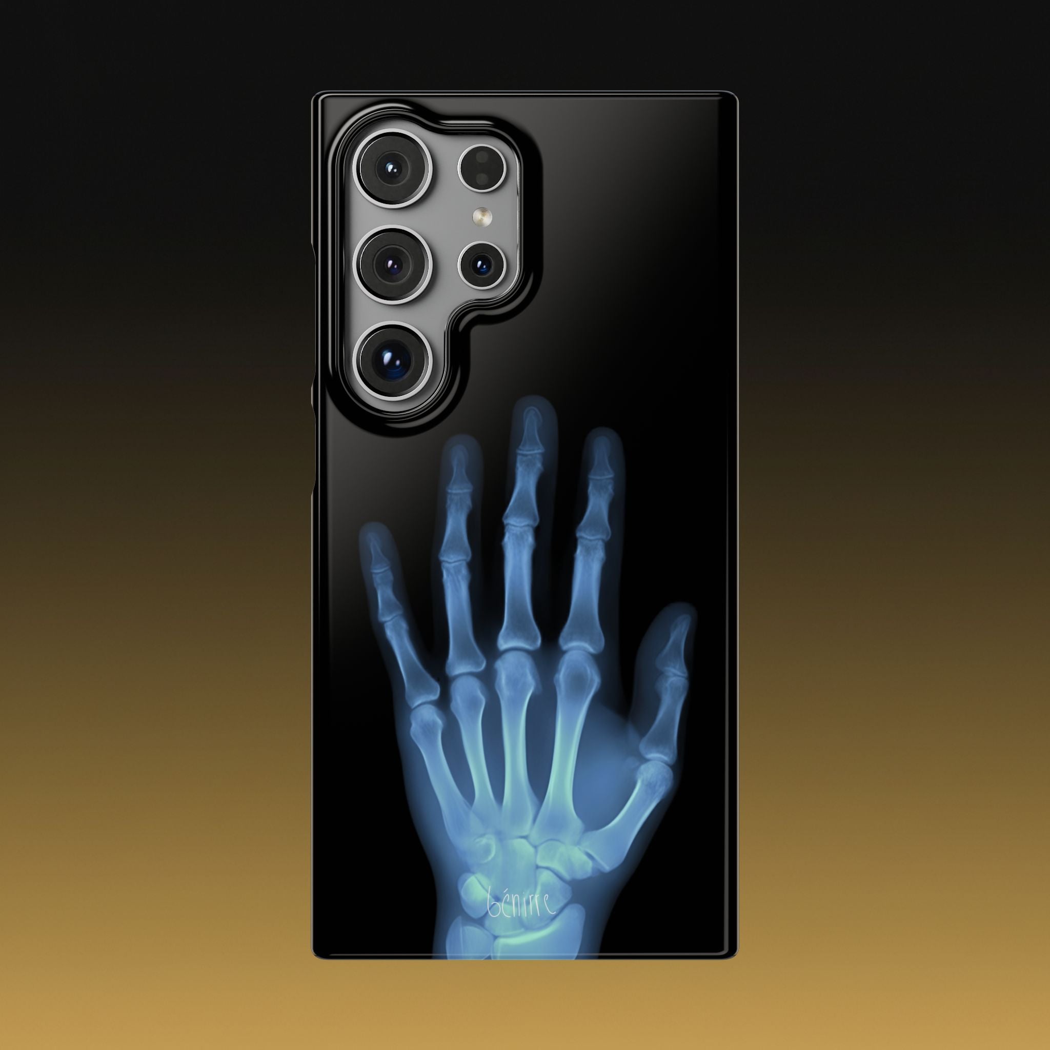 レントゲンライト