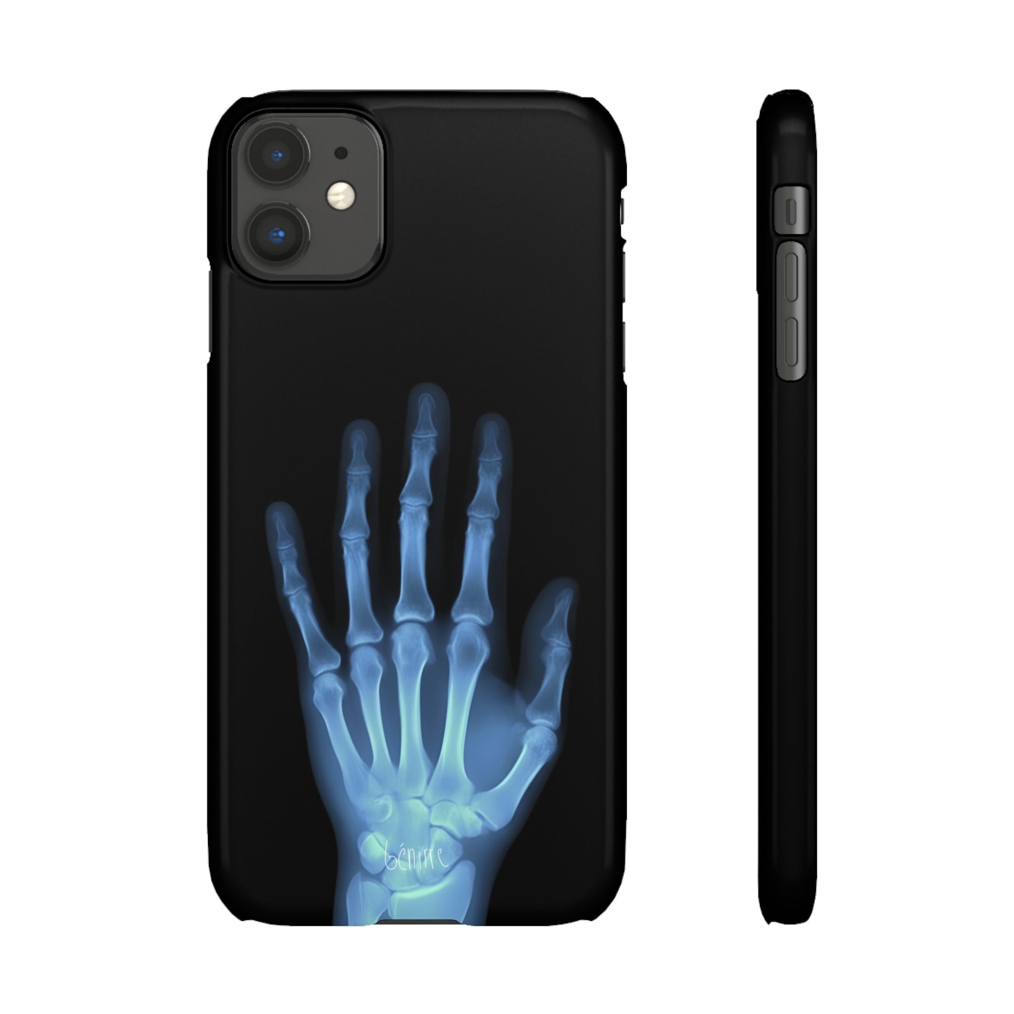 レントゲンライト