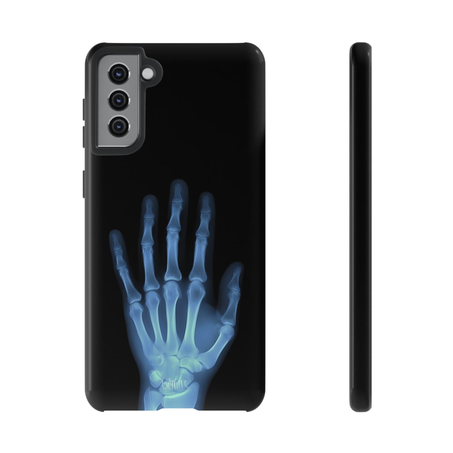 The Radiograph Tough Case