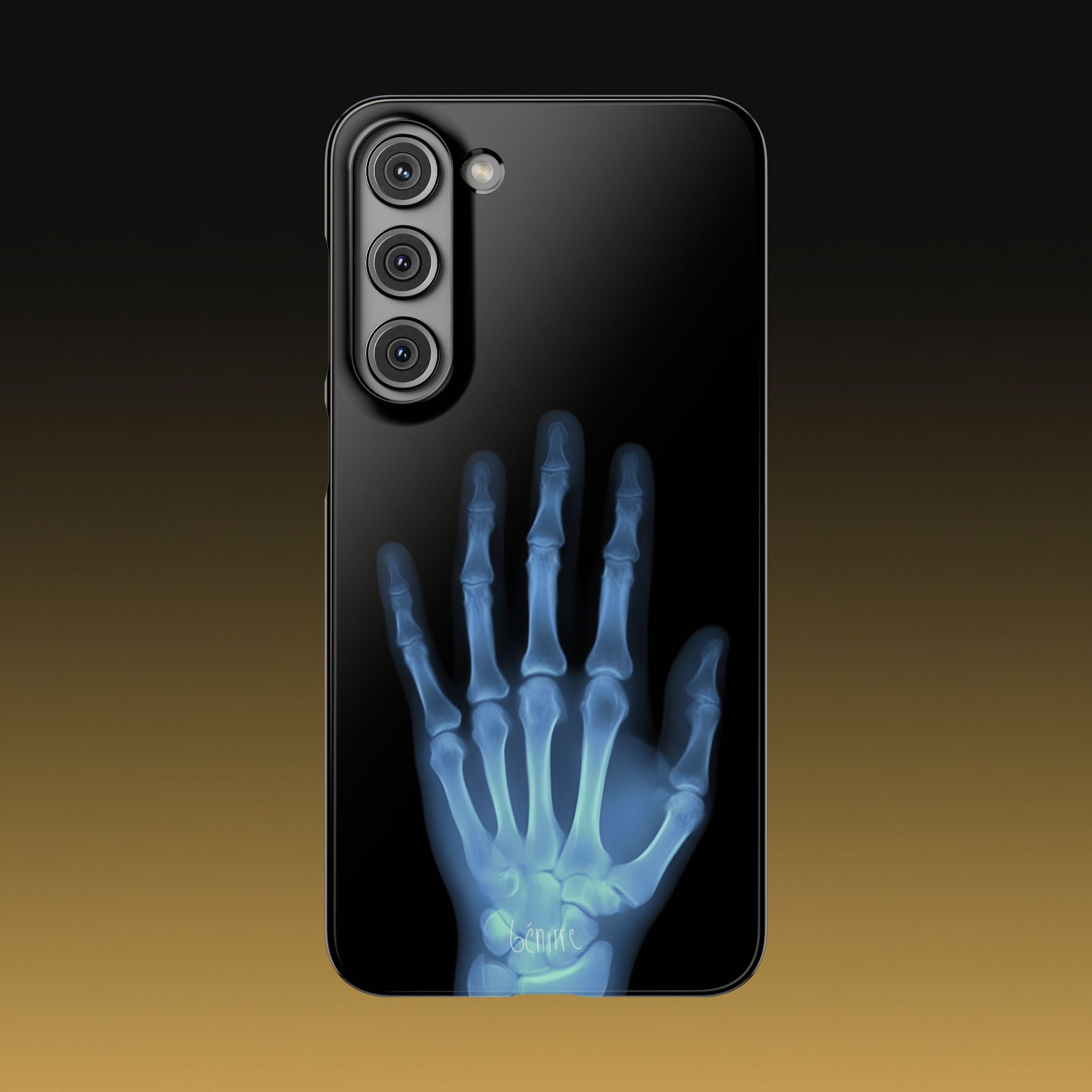 レントゲンライト