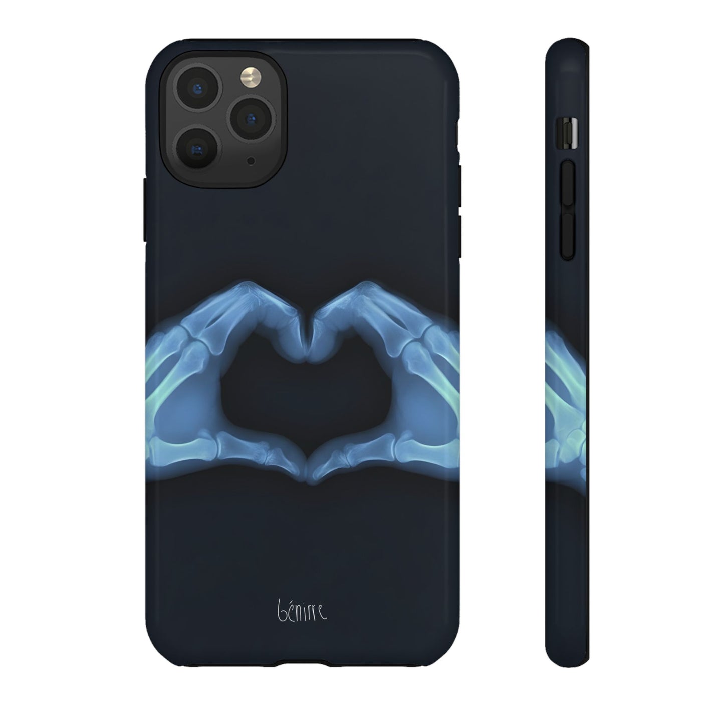 Bone Deep Tough Case