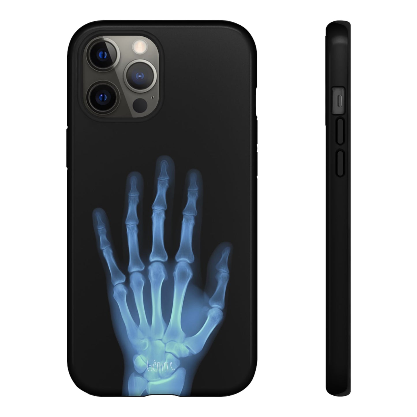 The Radiograph Tough Case