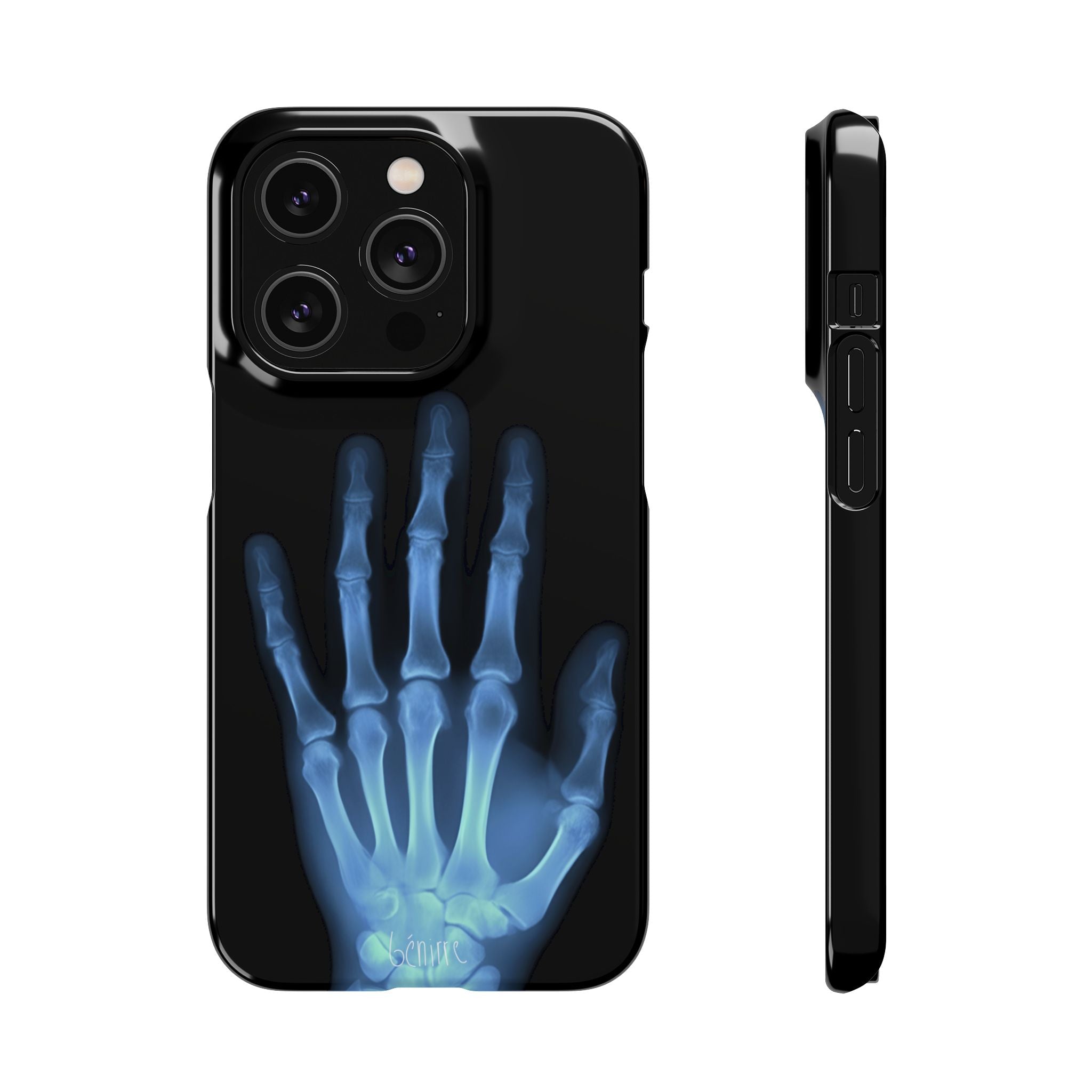 レントゲンライト