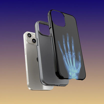 The Radiograph Tough Case