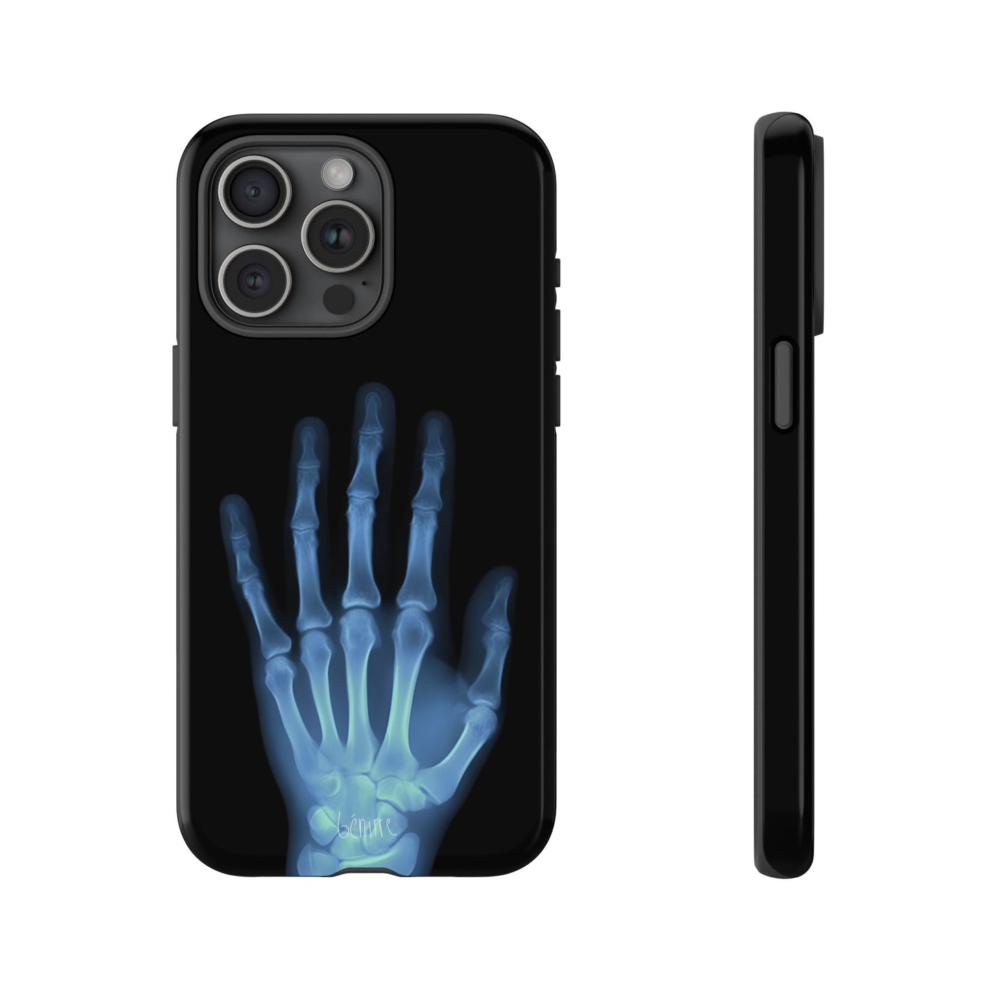 The Radiograph Tough Case