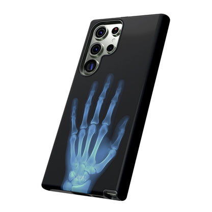 The Radiograph Tough Case