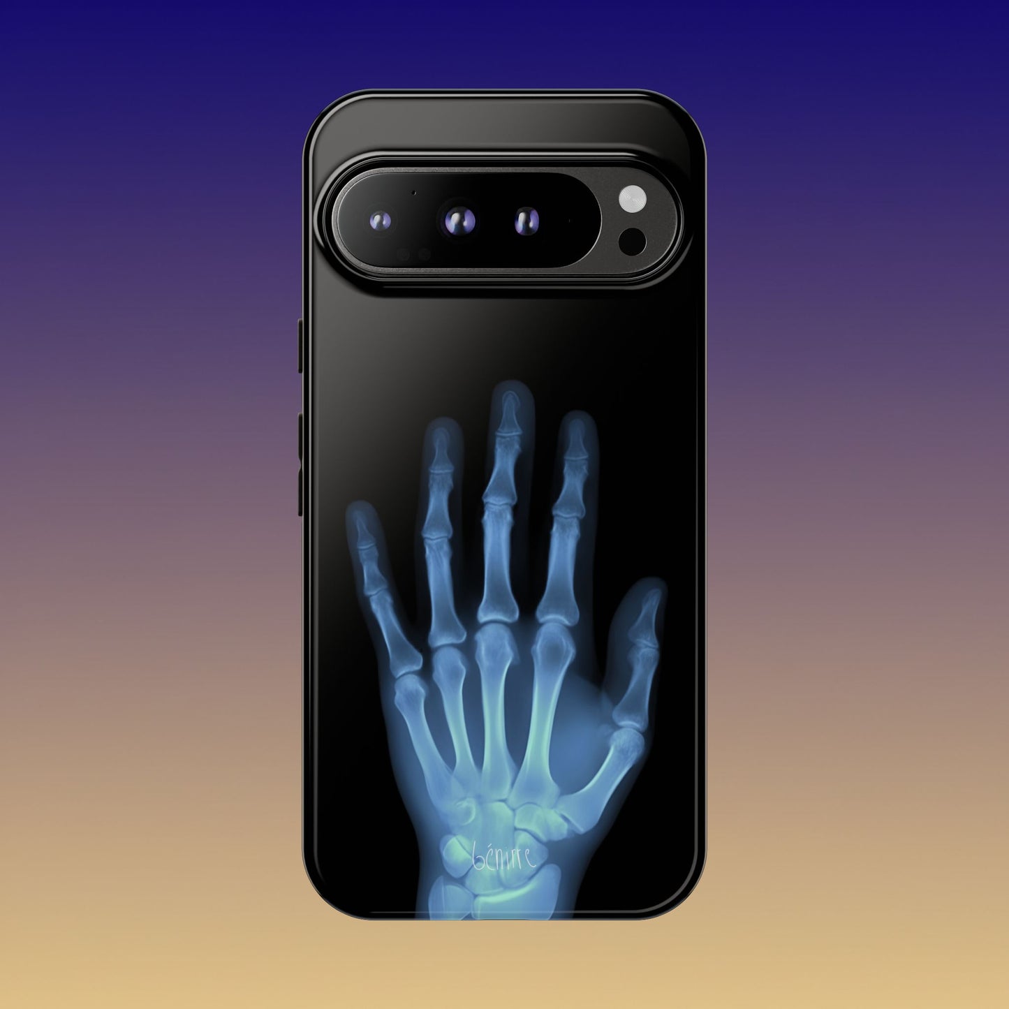 The Radiograph Tough Case