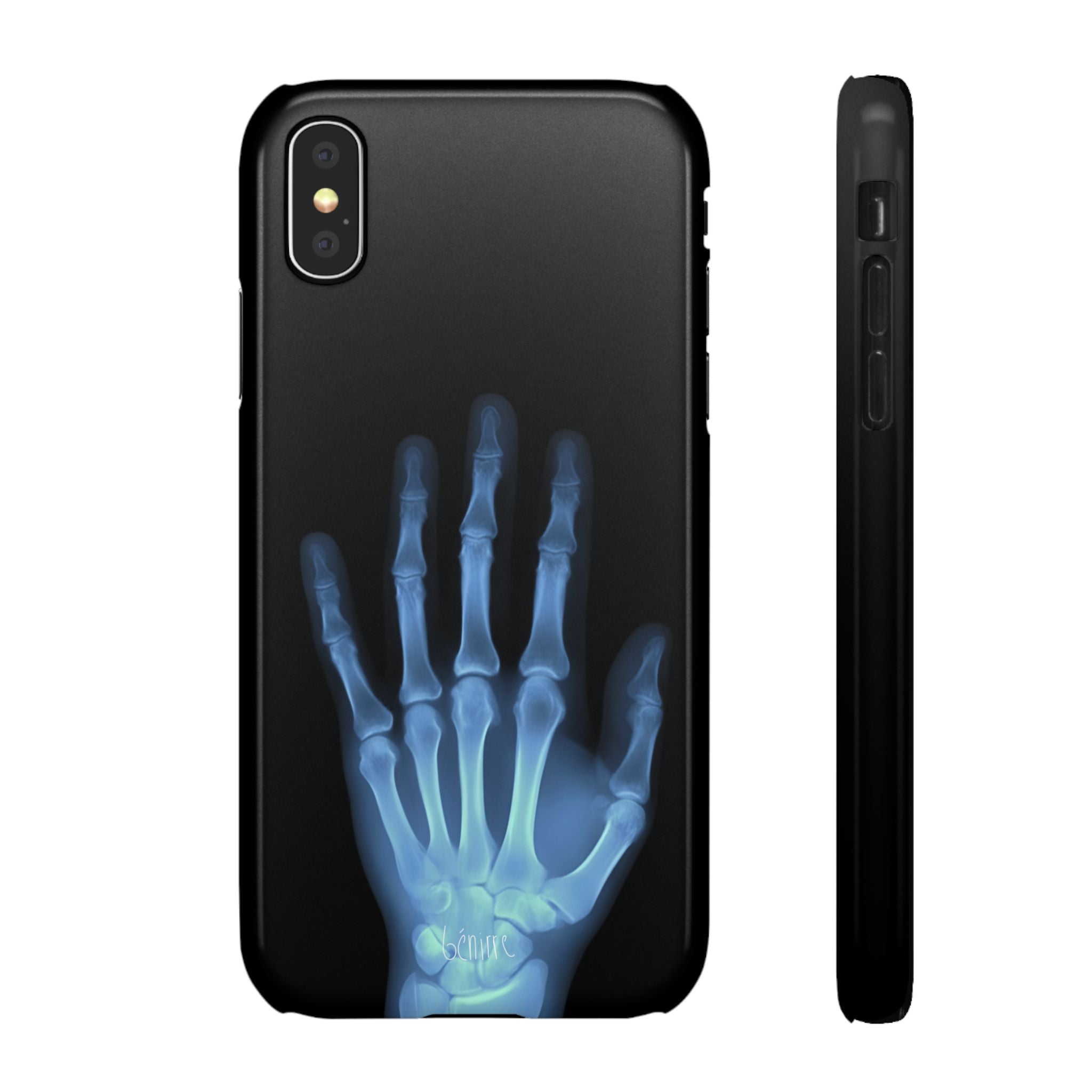 レントゲンライト