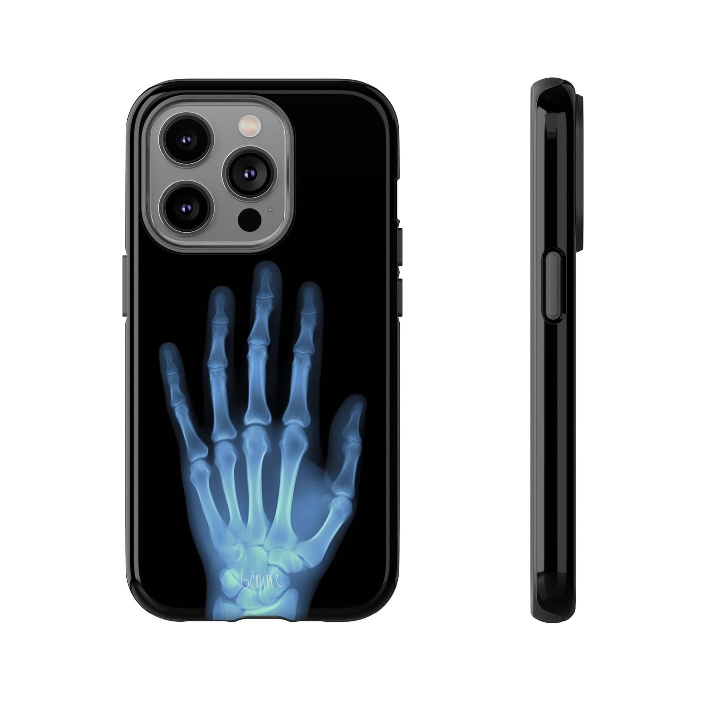 The Radiograph Tough Case