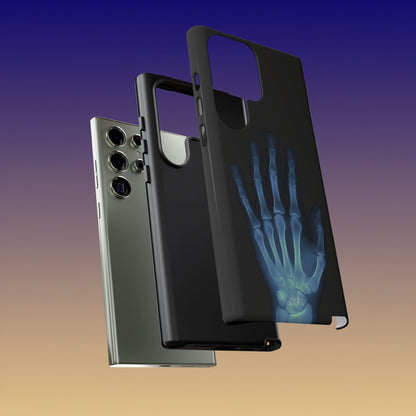 The Radiograph Tough Case