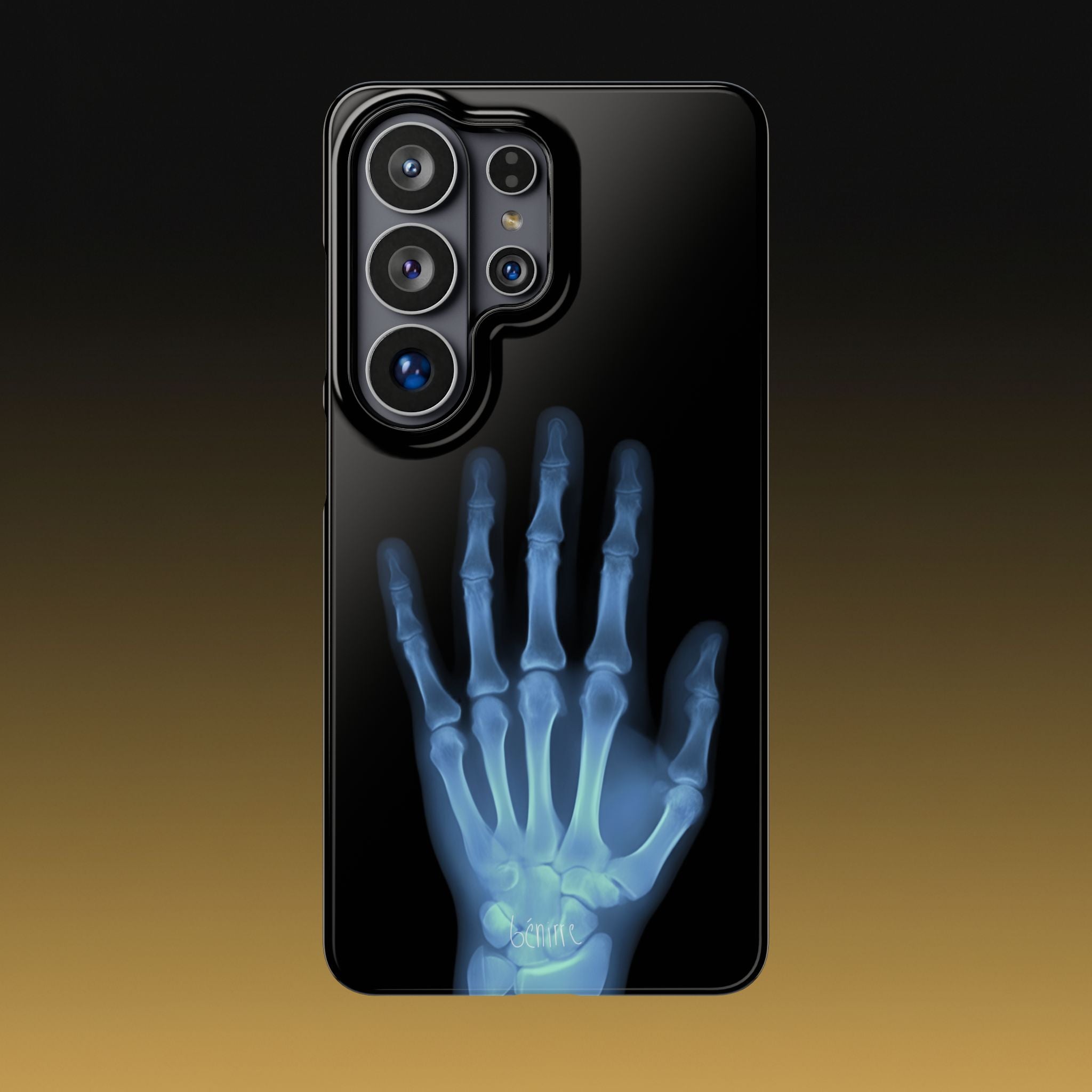 レントゲンライト