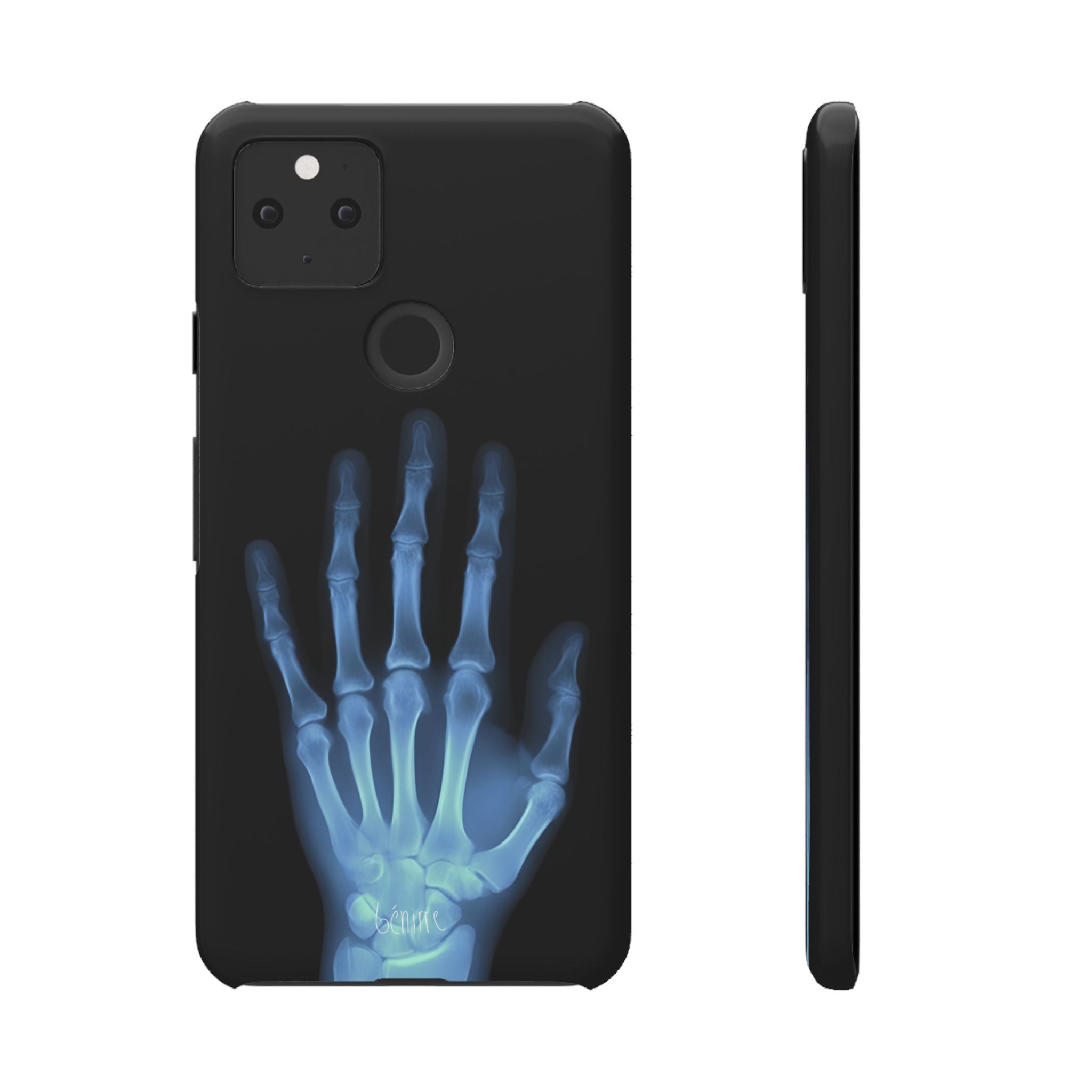 レントゲンライト