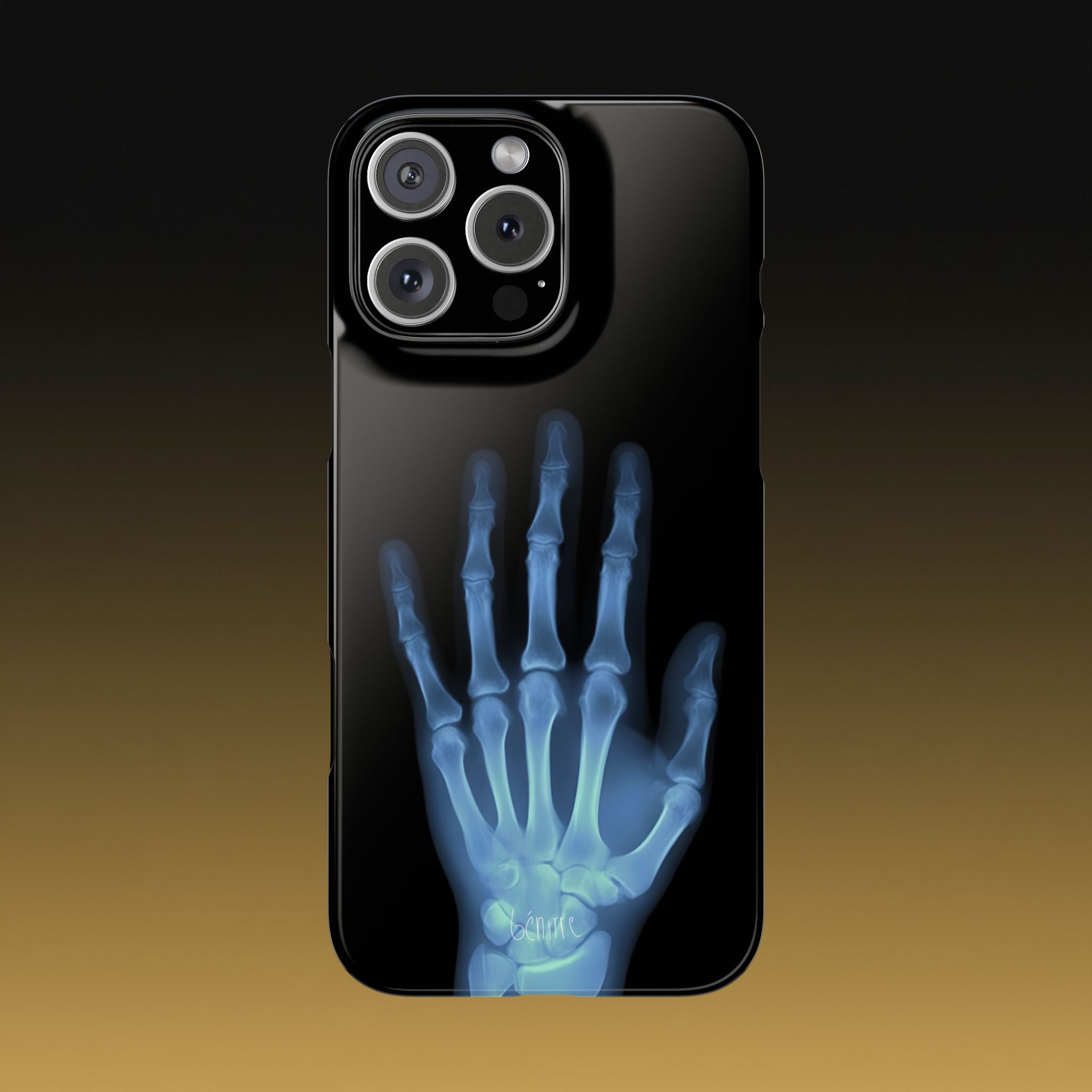 レントゲンライト