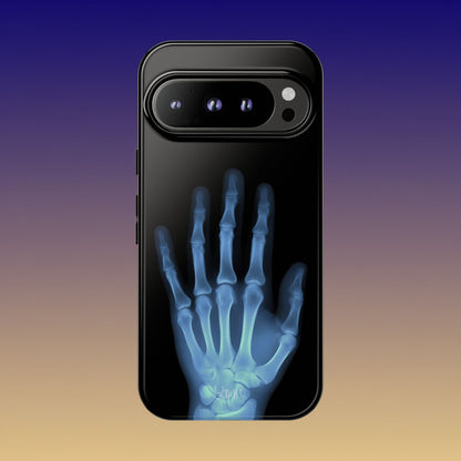 The Radiograph Tough Case