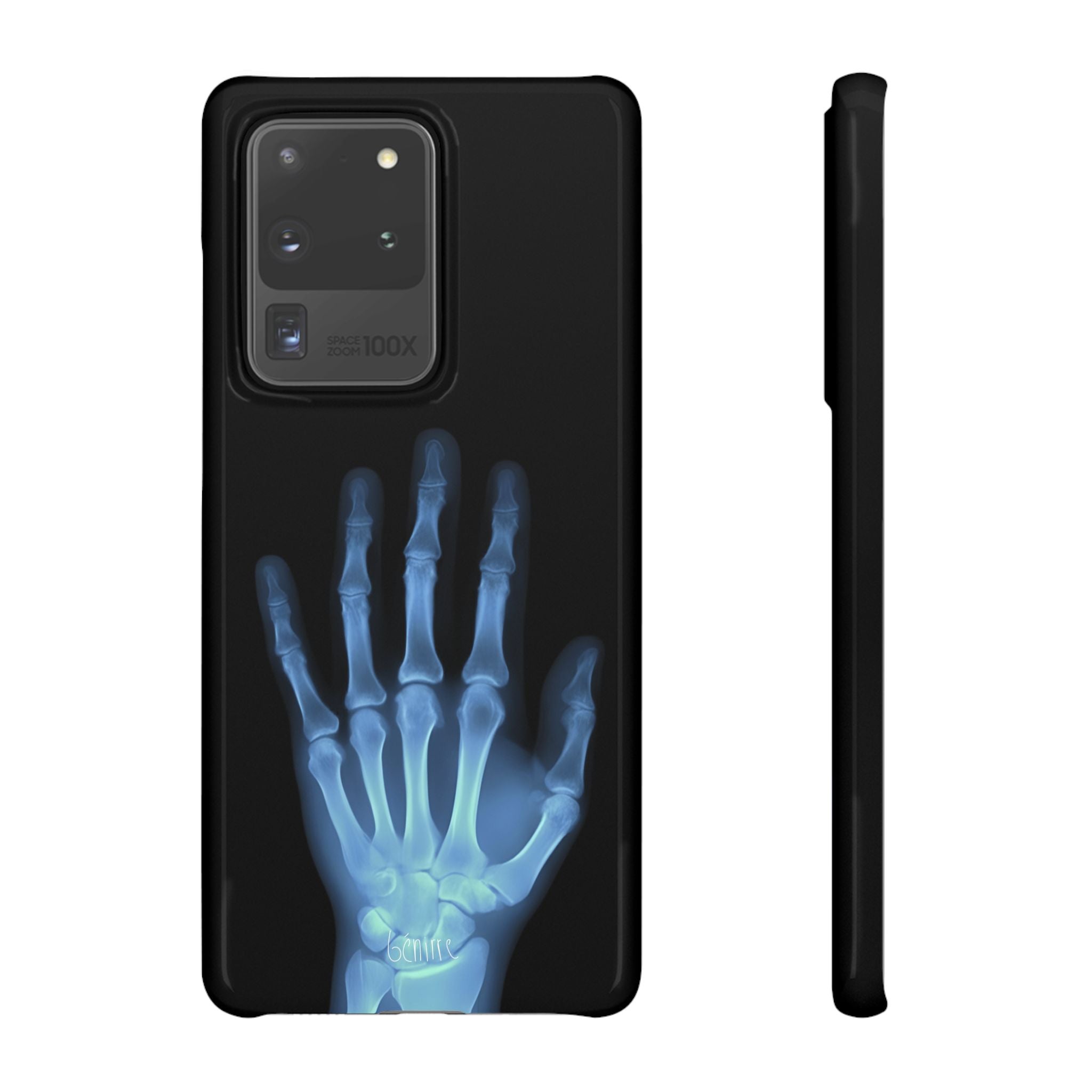 レントゲンライト