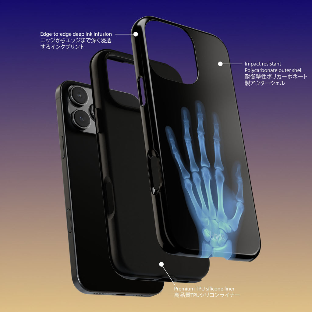 レントゲン写真