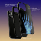 レントゲン写真